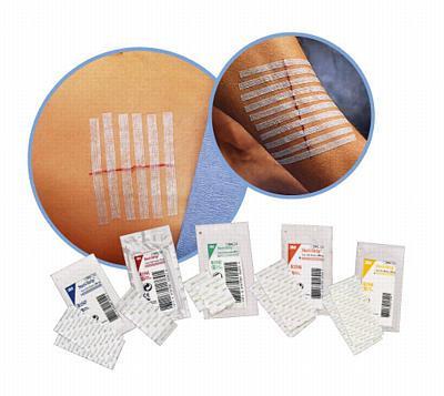 STERI-STRIP HAAVASULG 6*75MM NAHAVÄRVI 3 RIBA B1551 N1